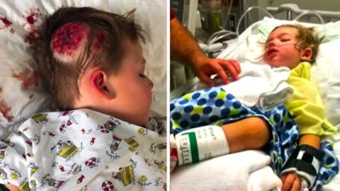 This Little Boy Was Shaky After Hitting His Head. Then Doctors Made An Alarming Discovery