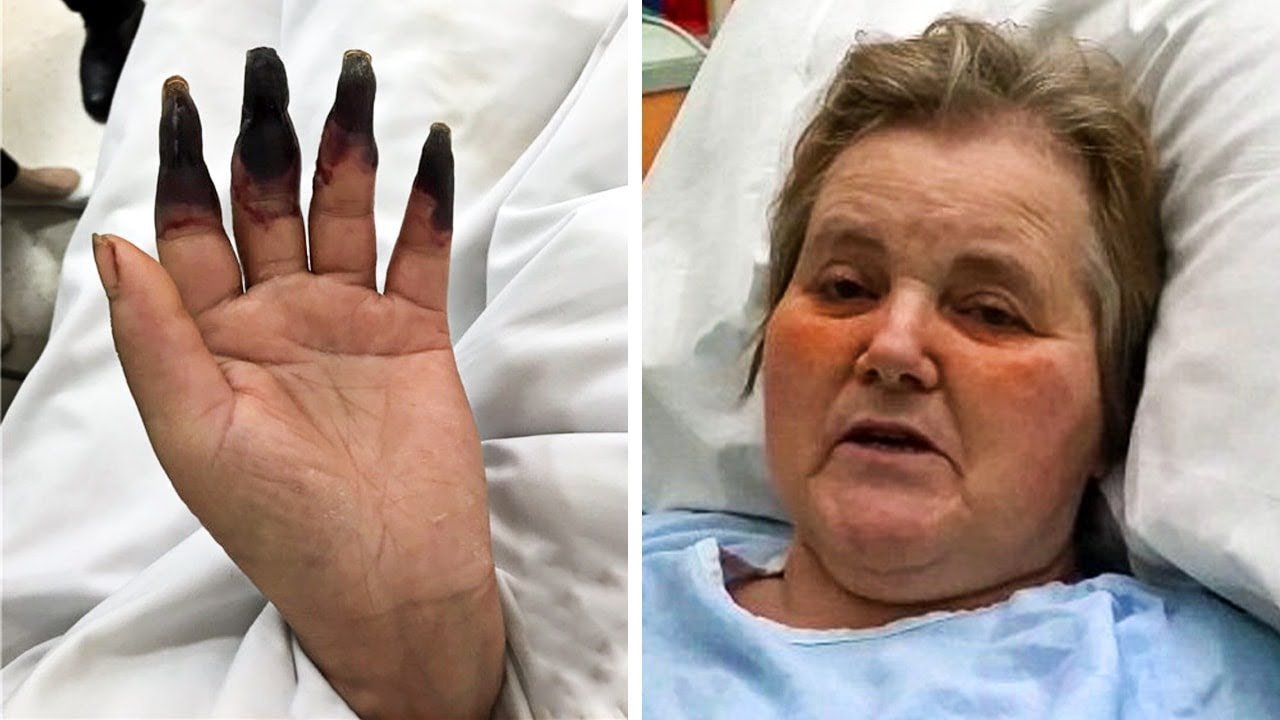 After Cleaning Her House for 2-Hours Straight – She Notices Her Fingers Turning Black