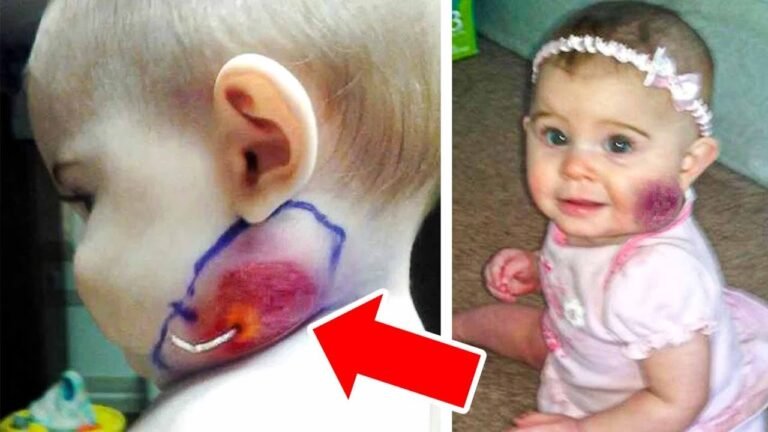 Mom Spots String Growing Out of Baby’s Face, Doctors Were Shocked To Find This…